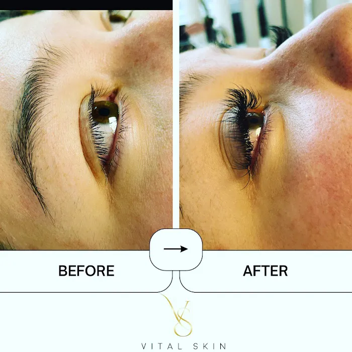 Vital Skin Picture 3