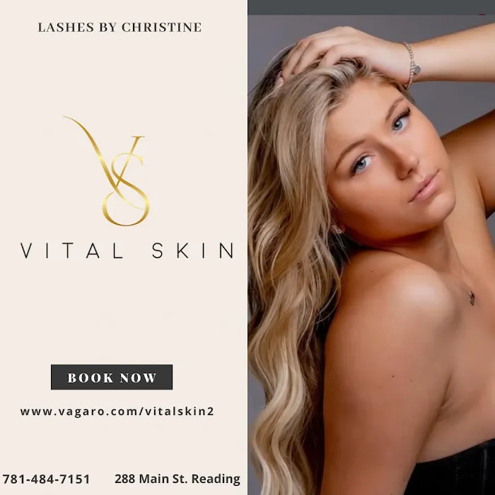 Vital Skin Picture 8