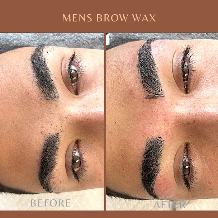 Vital Skin Picture 9