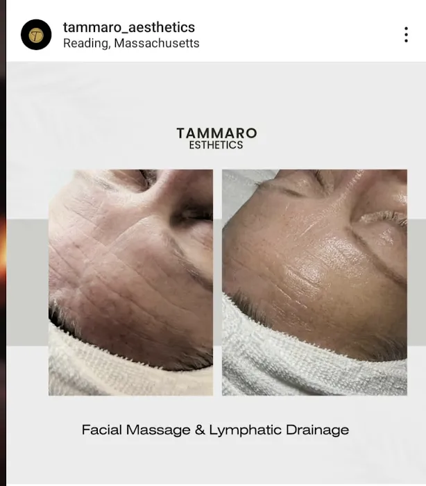 Tammaro Aesthetics / Skin Care & Electrology Picture 8