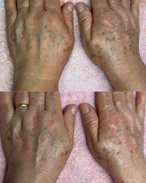 DF - Skin Beauty Aesthetics Advanced Picture 5