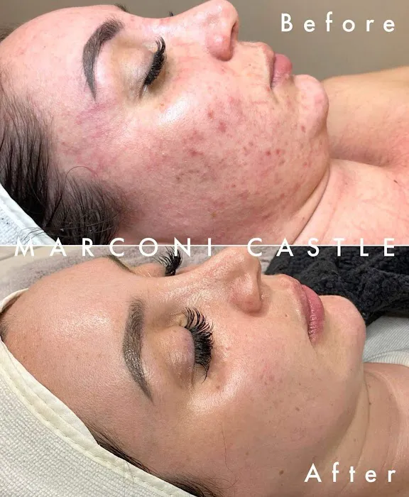 Marconi Castle: Skin + Spa Picture 3