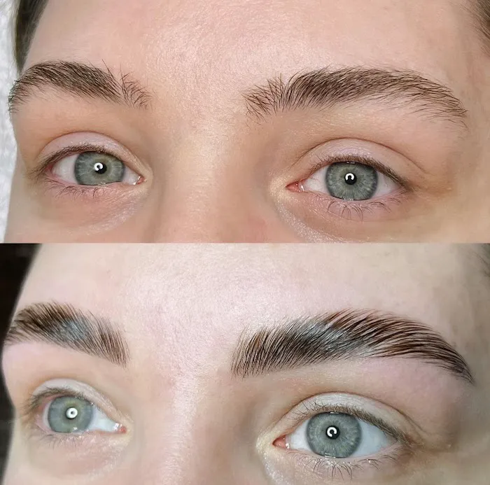 Everglow Esthetics Picture 5