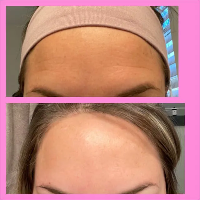 Juniper Aesthetics, LLC Picture 6