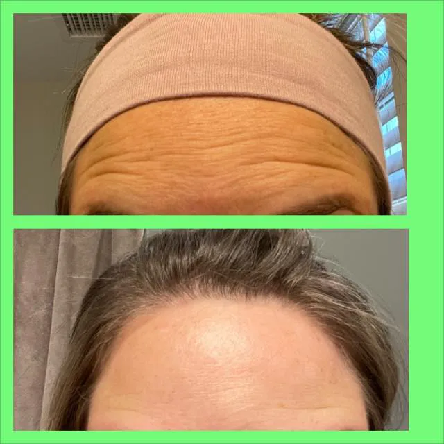 Juniper Aesthetics, LLC Picture 5