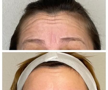 Juniper Aesthetics, LLC