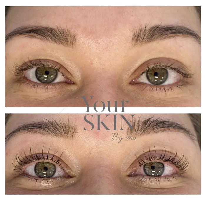 Your skin by me Picture 2