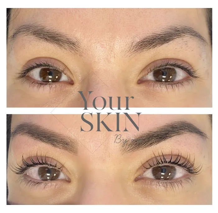 Your skin by me Picture 5