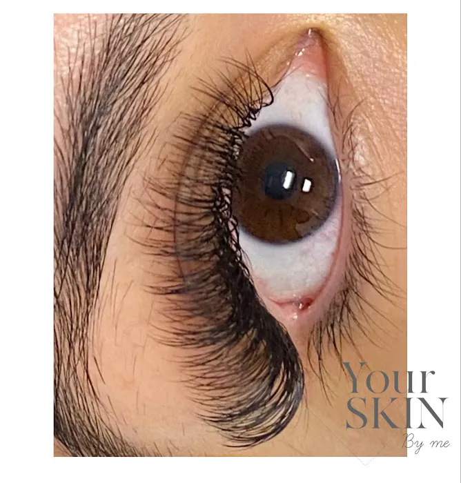 Your skin by me Picture 4