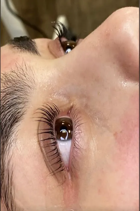 Your skin by me Picture 3