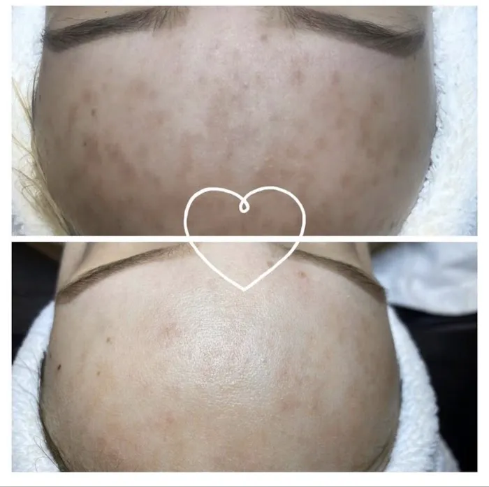 Your skin by me Picture 8