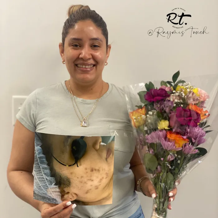 Raymi's Touch Esthetics, LLC Picture 6