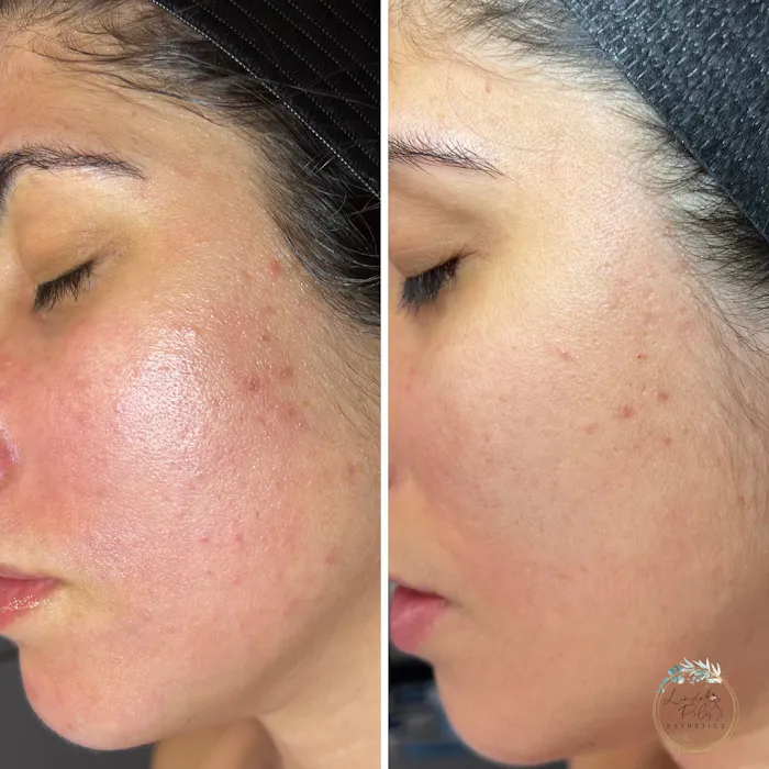 Linda Pele Esthetics Picture 9