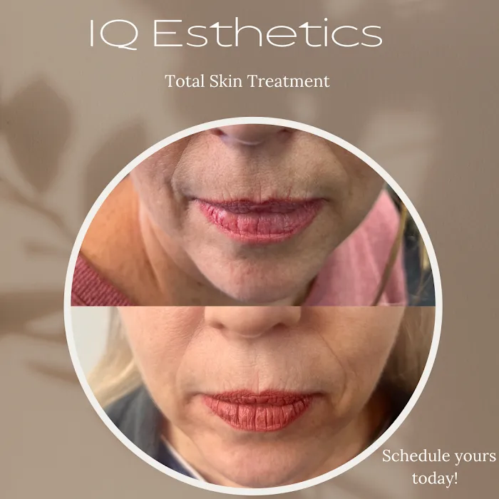 IQ Esthetics Picture 10