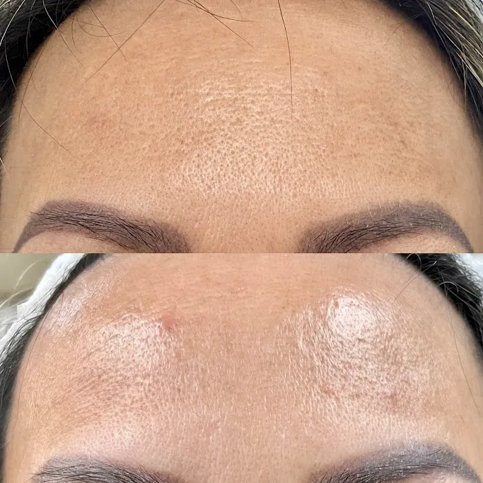 IQ Esthetics Picture 1