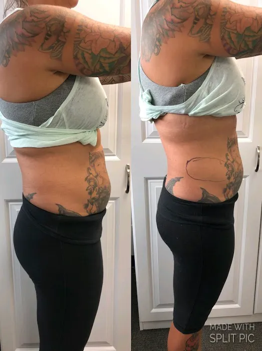 IQ Esthetics Picture 9