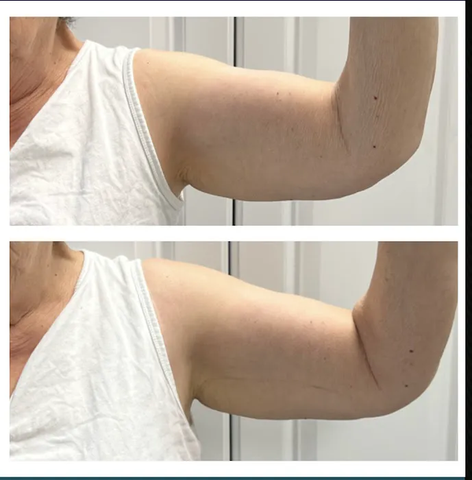 IQ Esthetics Picture 2