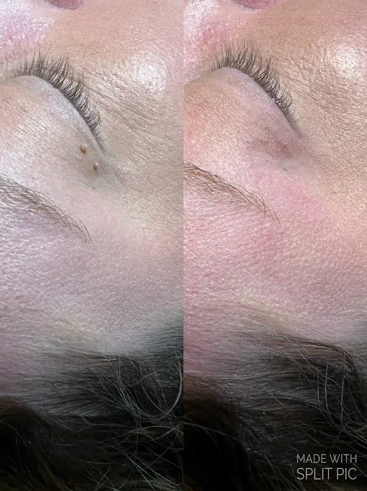 IQ Esthetics Picture 6