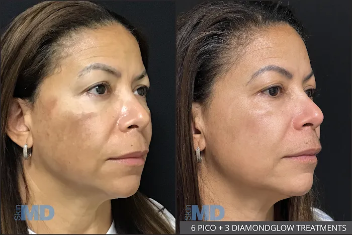 SkinMD Peabody Picture 6