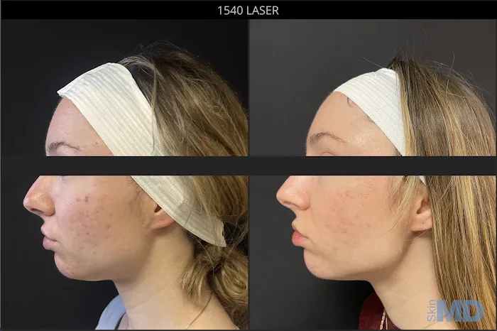 SkinMD Peabody Picture 9