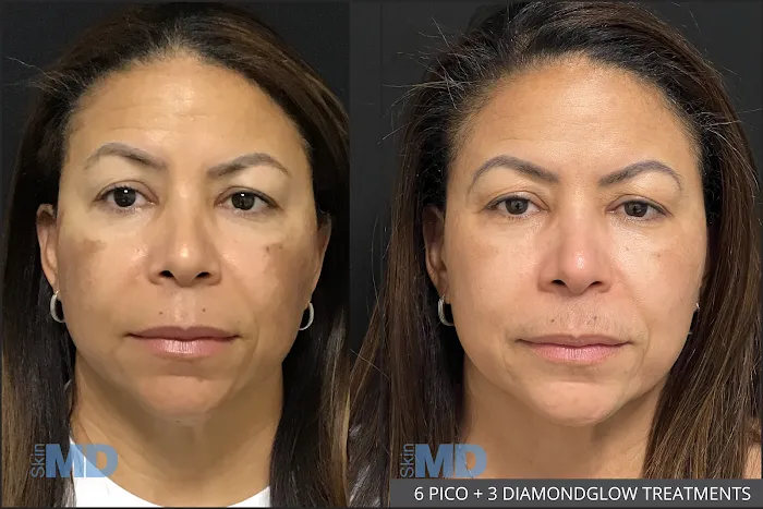 SkinMD Peabody Picture 10