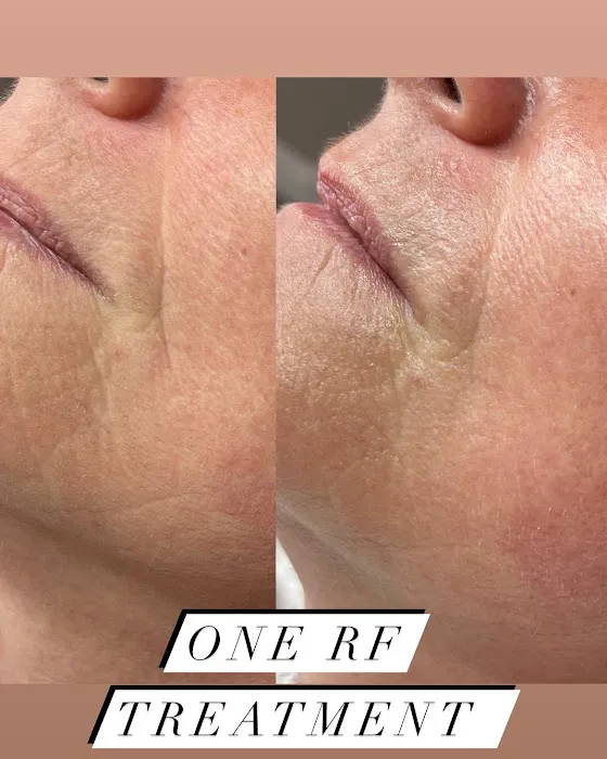 KD Gloss Aesthetics Picture 6