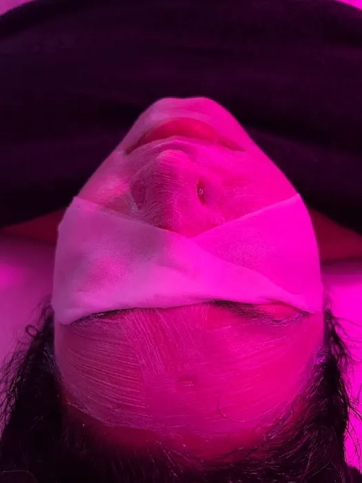 Blissface Esthetics Picture 5