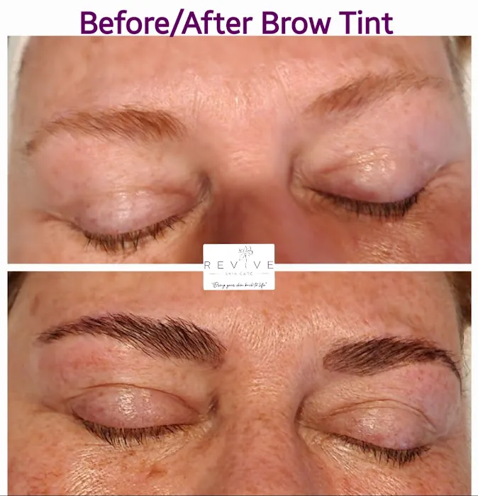 Revive Skin Care, LLC Picture 7