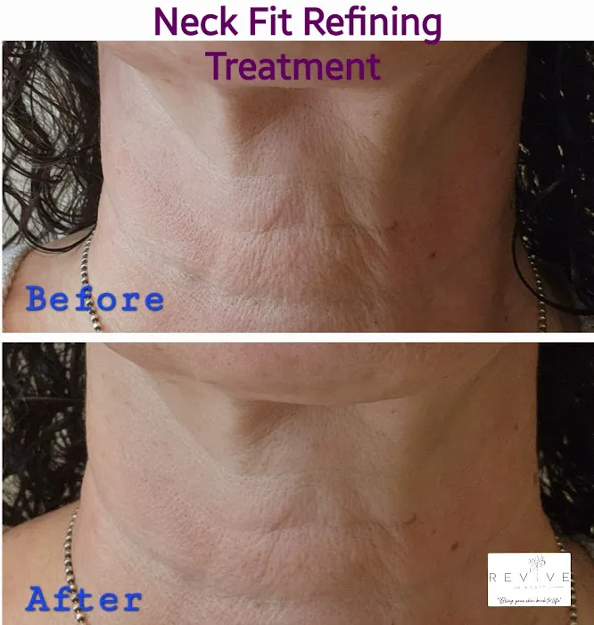 Revive Skin Care, LLC Picture 2