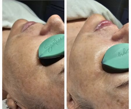 Revive Skin Care, LLC