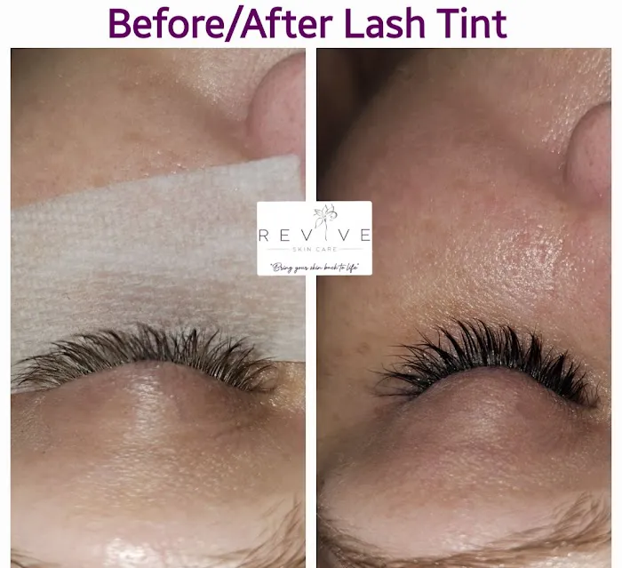 Revive Skin Care, LLC Picture 5