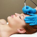 IPL and Skin Wellness