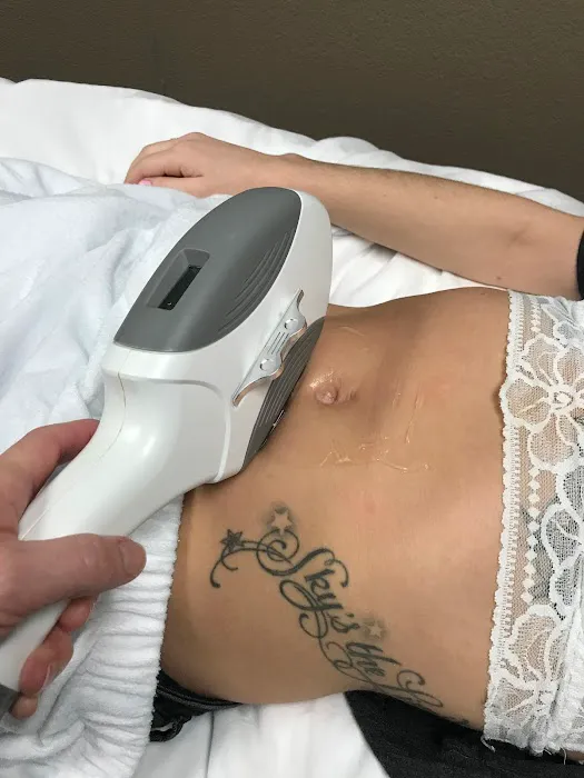 IPL and Skin Wellness Picture 3