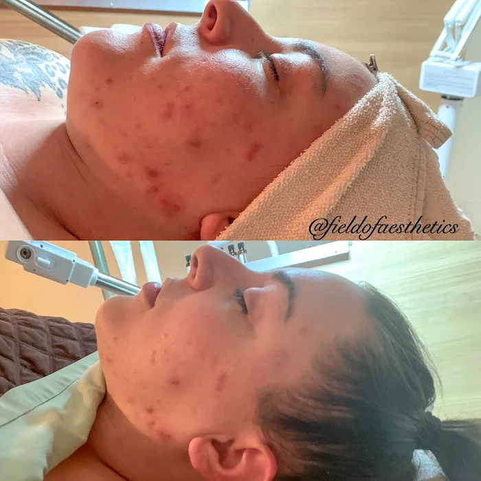 Field of Aesthetics Picture 5