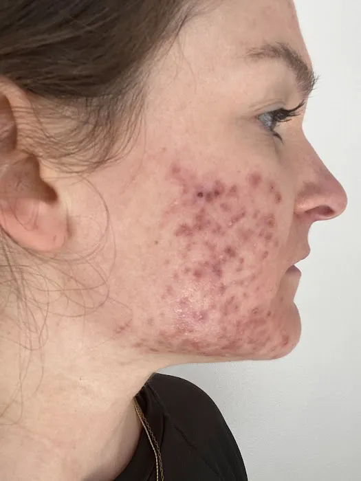 Saving Faces Holistic Skin Care Picture 1