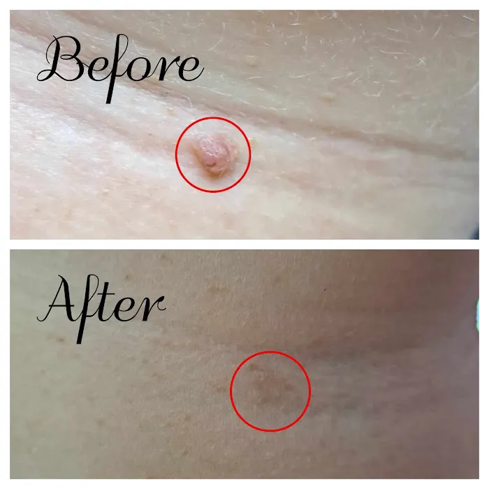 Tranquil Touch Picture 5