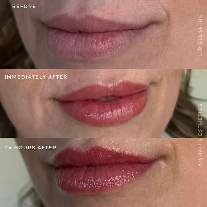 Aishahs Esthetics Picture 7