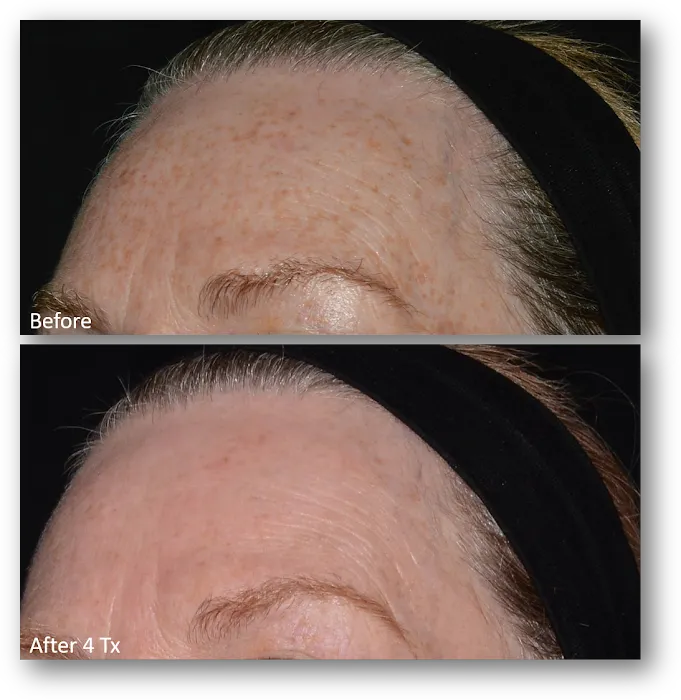 Revive Skin Clinic of Maine Picture 6