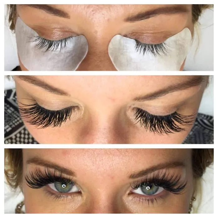 Absolutely Electrolysis & Skin Care Picture 4