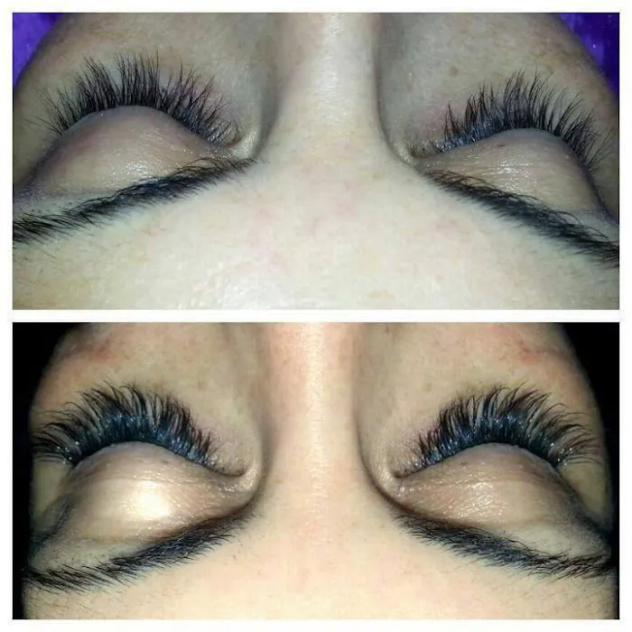 Absolutely Electrolysis & Skin Care Picture 10