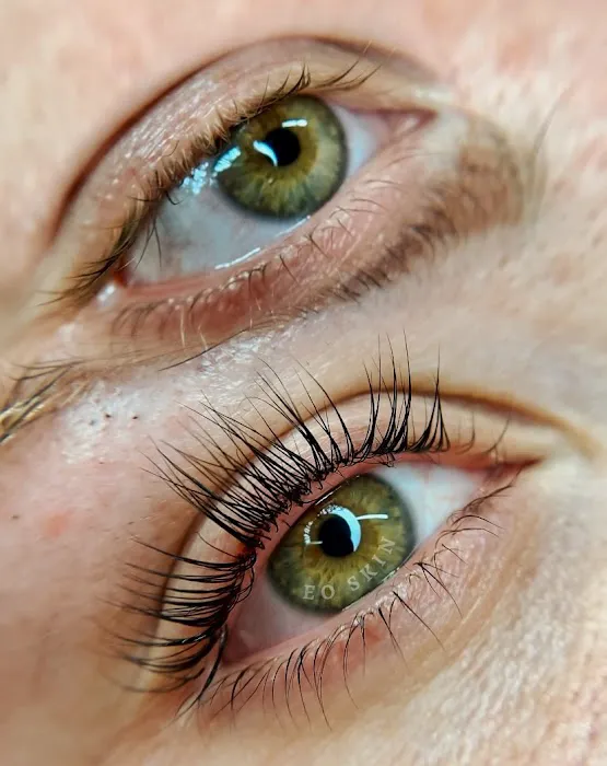 EO SKIN Aesthetics Picture 1