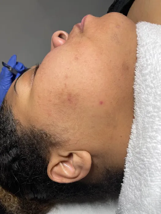 CEVEN SKIN Picture 2