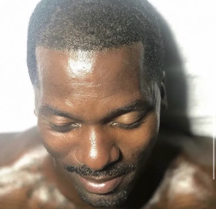 CEVEN SKIN Picture 1