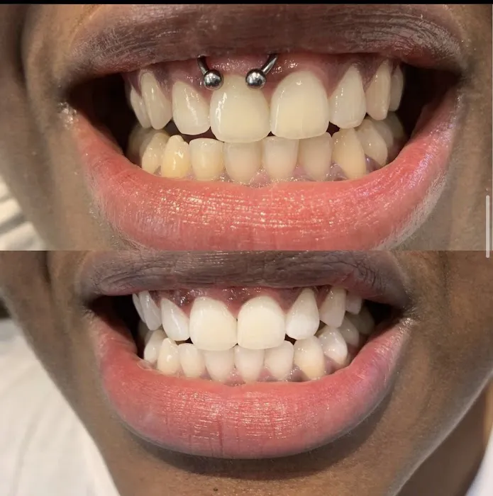 CEVEN SKIN Picture 3