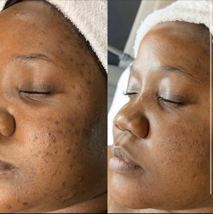 CEVEN SKIN Picture 4