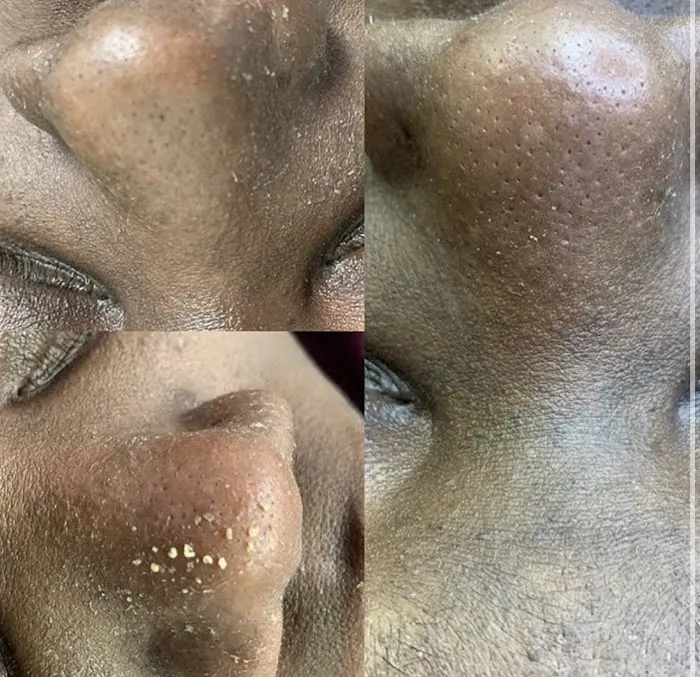 CEVEN SKIN Picture 5