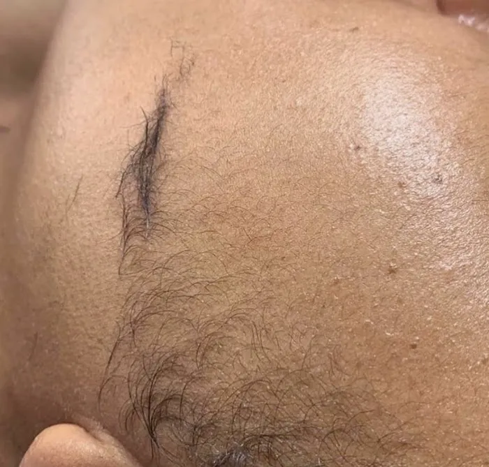 CEVEN SKIN Picture 7