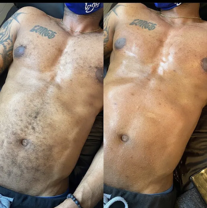 CEVEN SKIN Picture 6