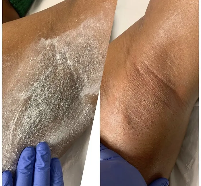 CEVEN SKIN Picture 10