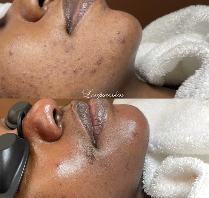 Lexipureskin Aesthetics Picture 2